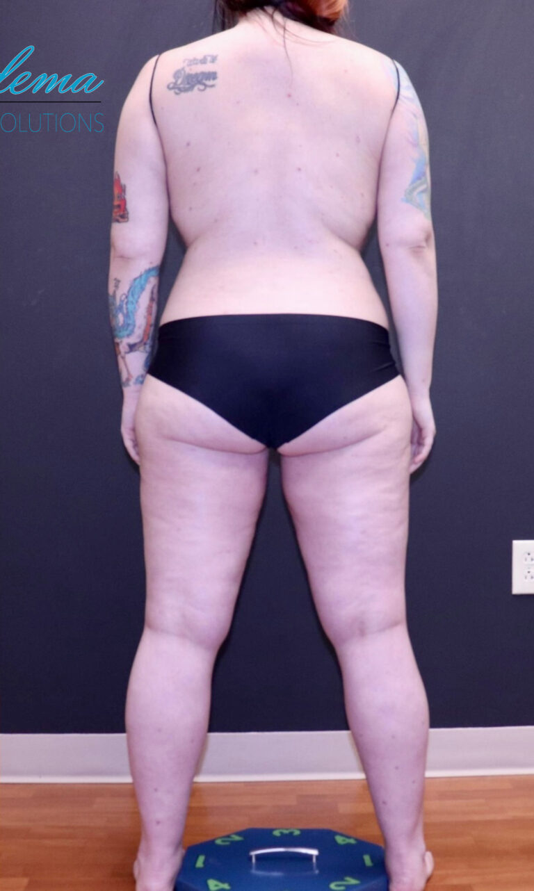 After Image: Full Body - back