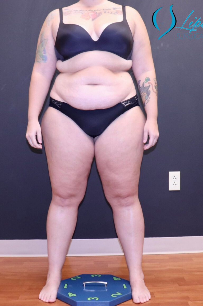 Before Image: Full Body - front