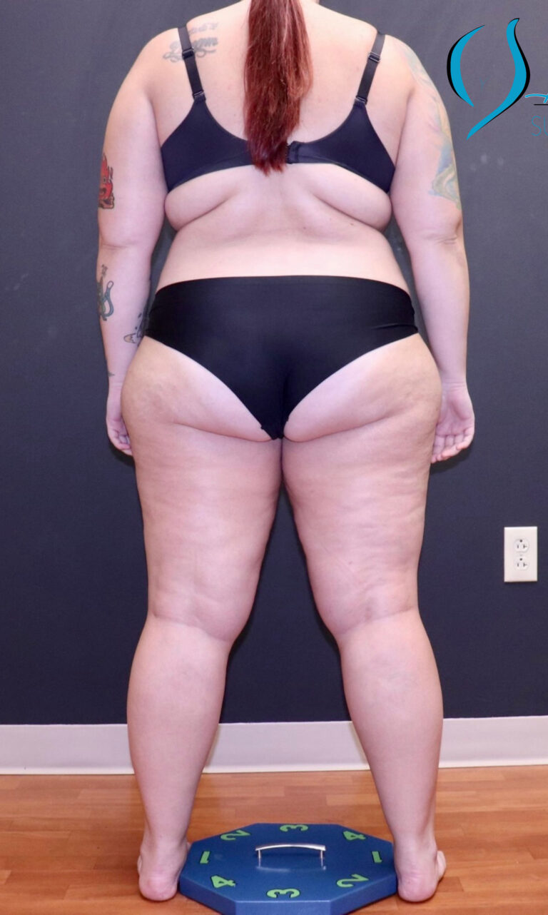 Before Image: Full Body - back
