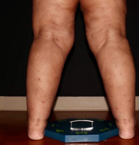 After Image: Calves