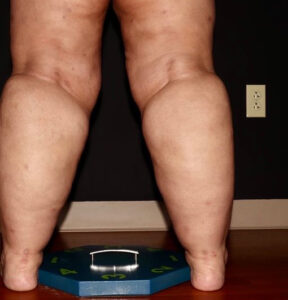 Before Image: Calves