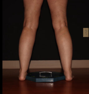 Before Image: Calves