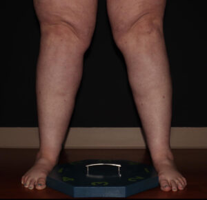 After Image: Calves