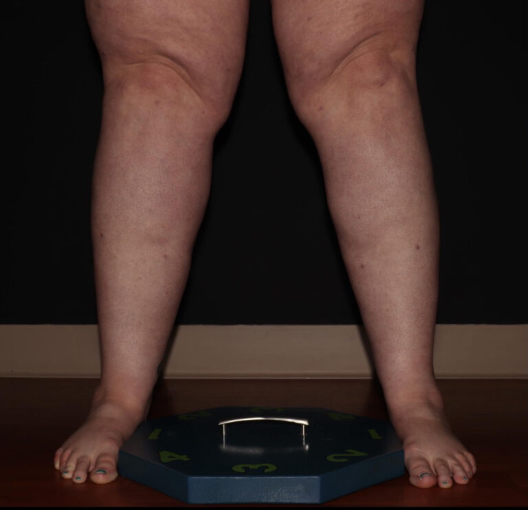 After Image: Calves - front