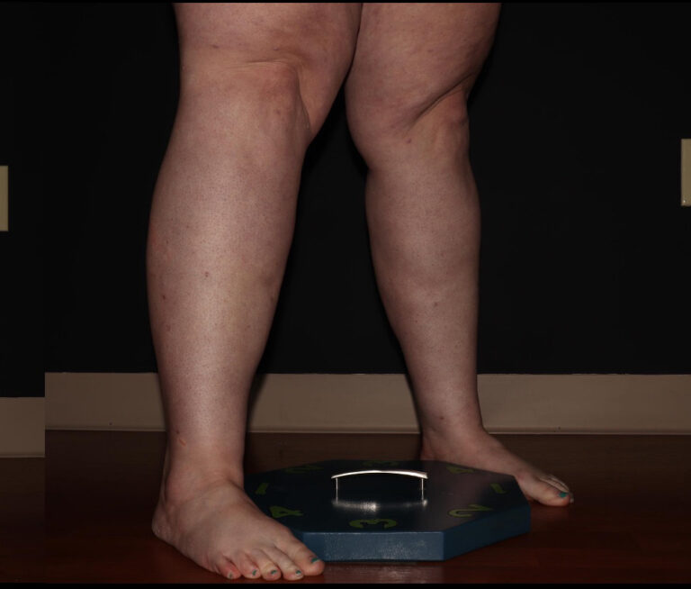 After Image: Calves - right-front-oblique