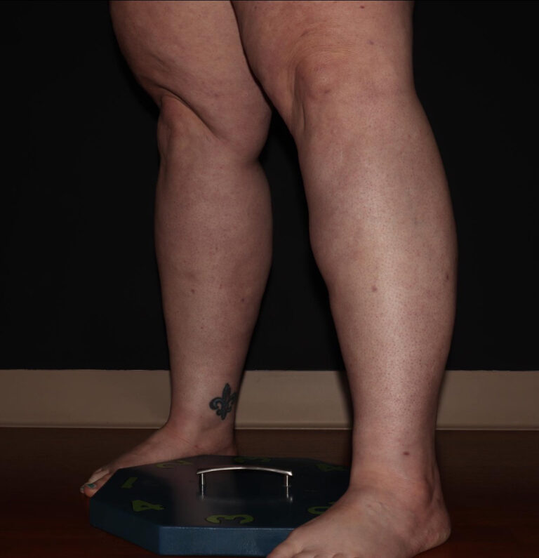 After Image: Calves - left-front-oblique
