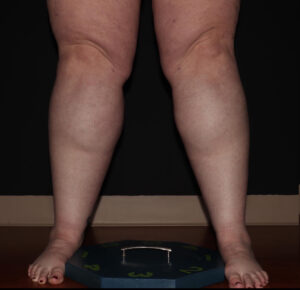 Before Image: Calves