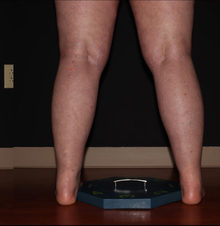 After Image: Calves - back
