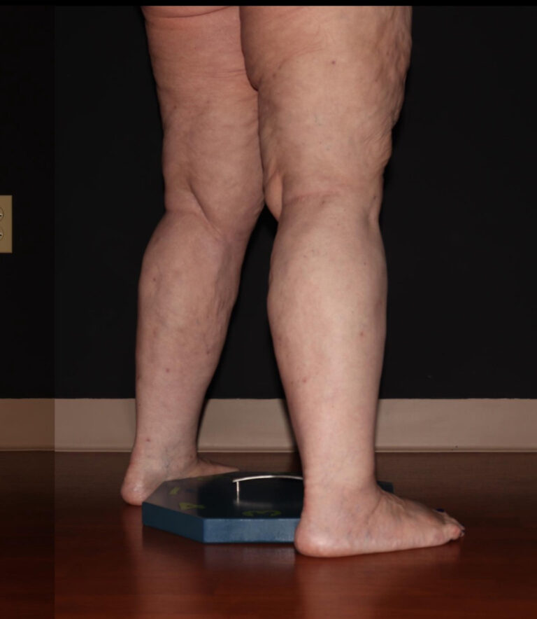 After Image: Calves - right-back-oblique