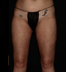 After Image: Thighs