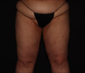 After Image: Thighs