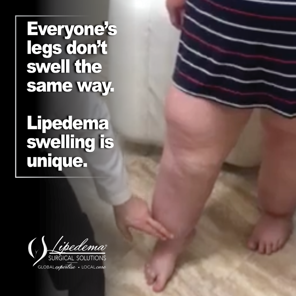 LSS 2026 3 March Lipedema Awareness3